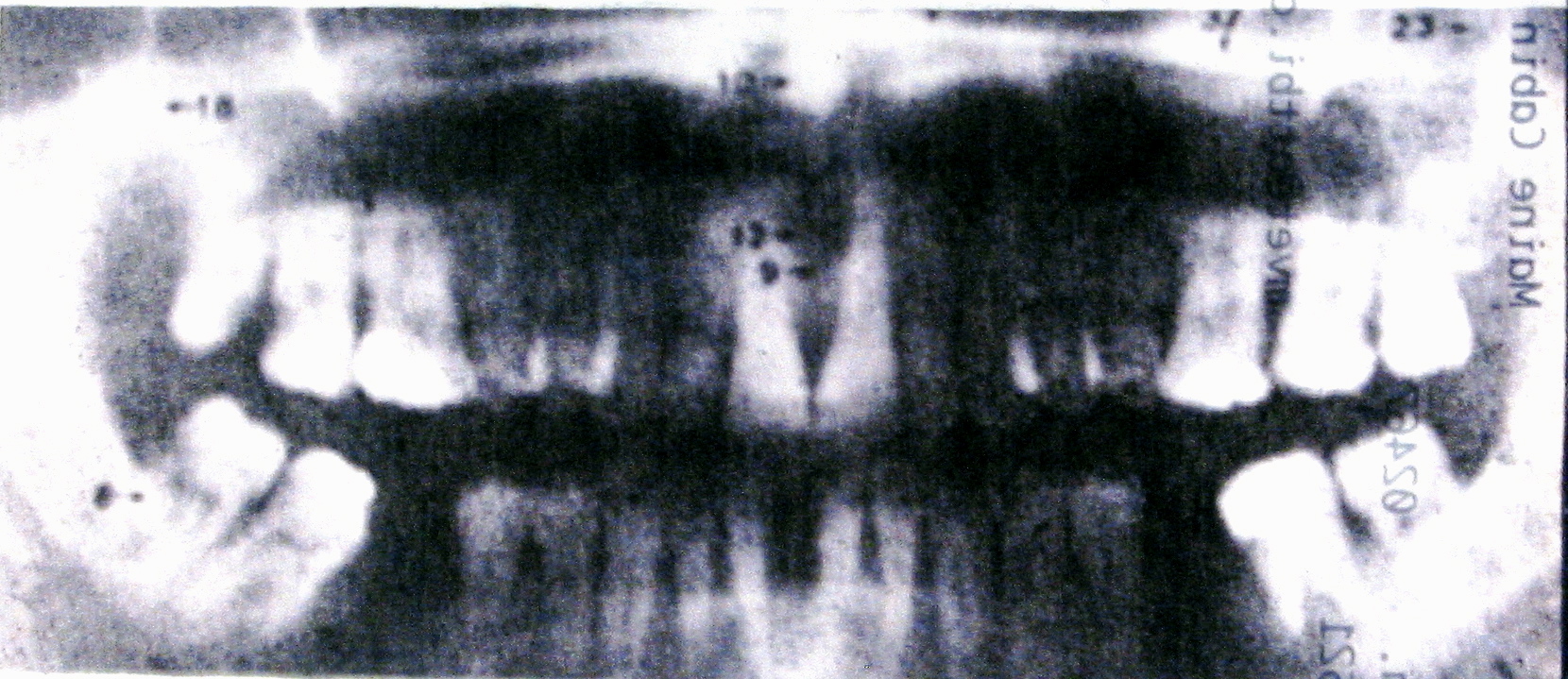 teeth.jpeg
